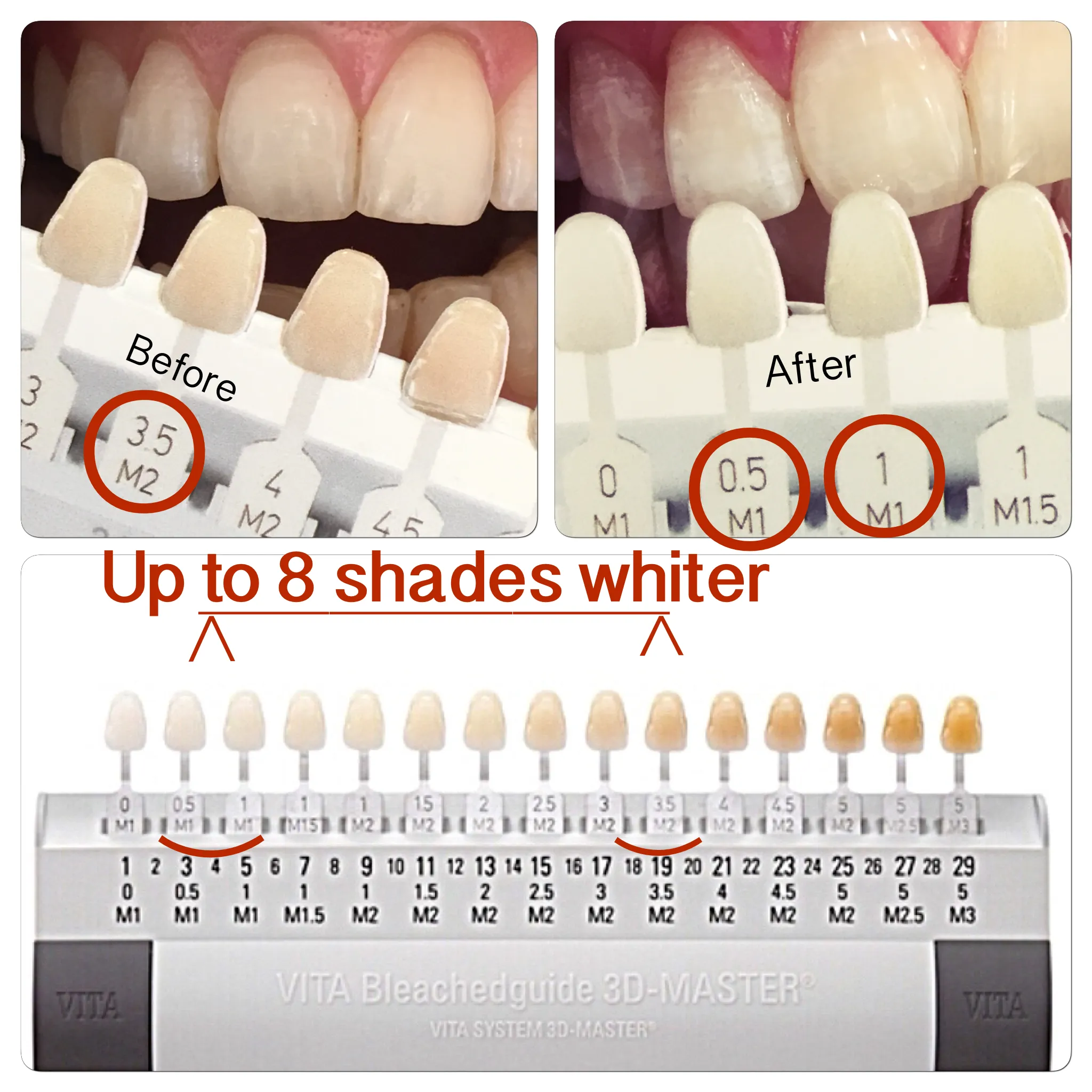 29368 professional consultation