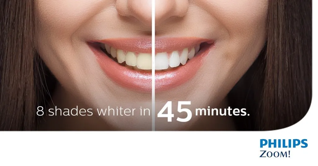29372 zoom teeth whitening long island quick results
