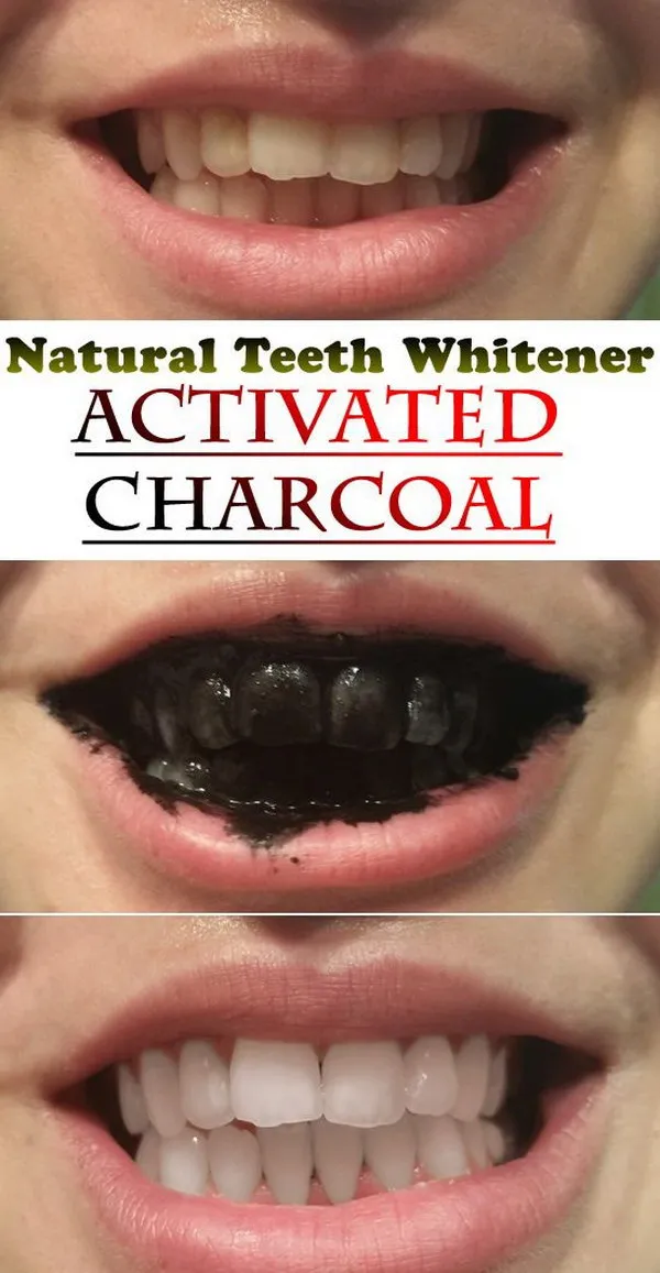 /img/29380-apple-cider-vinegar-teeth.webp