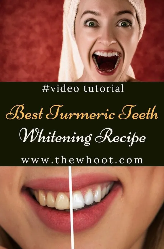 29380 strawberry teeth whitening