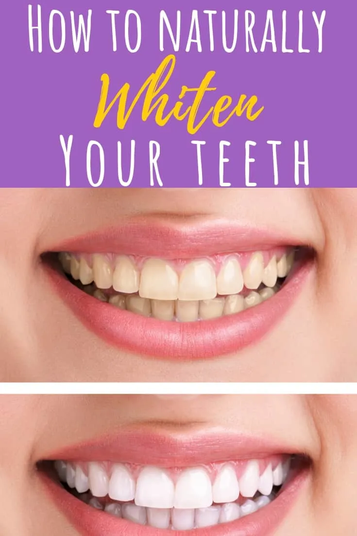 29380 teeth whitening ingredients