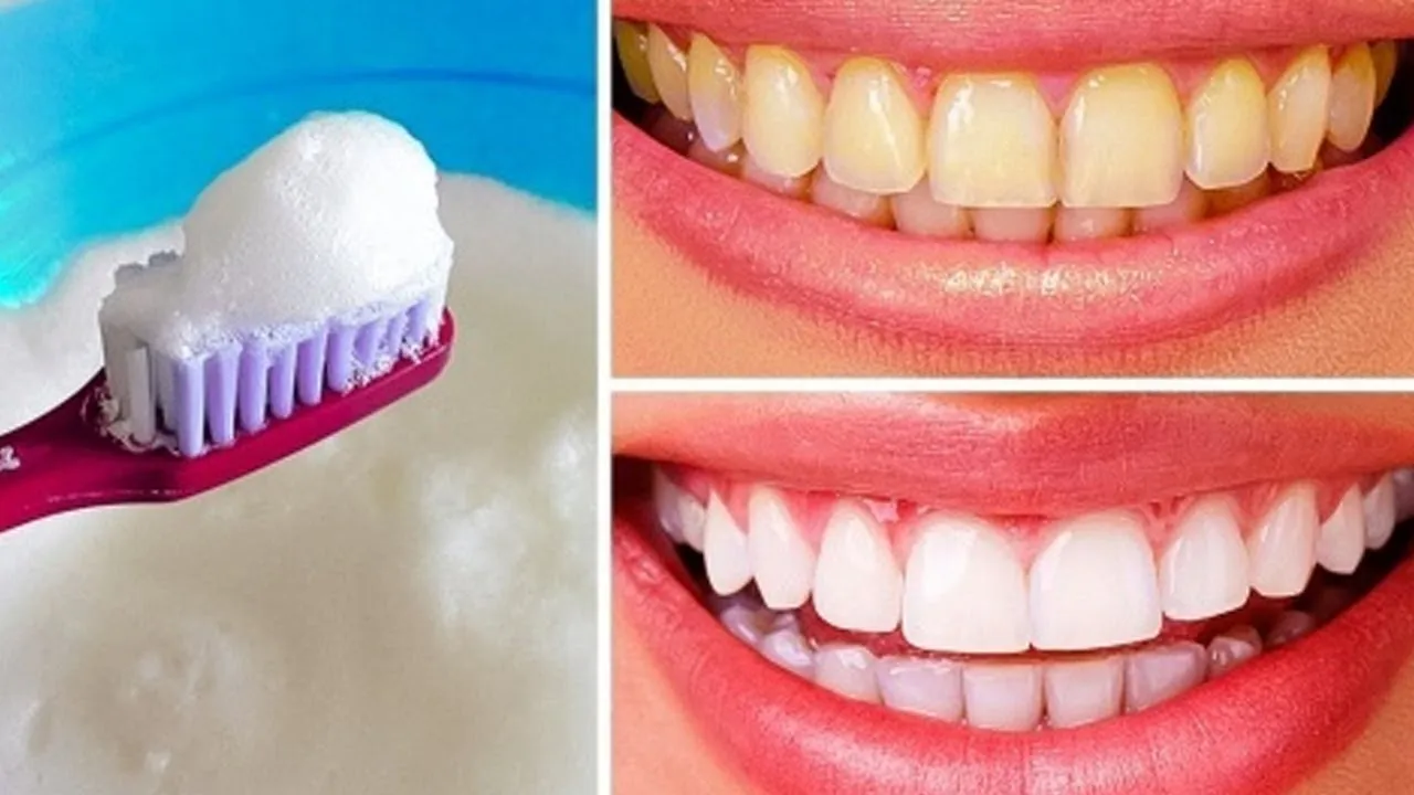 29384 baking soda and lemon teeth whitening