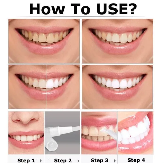 29386 how to choose whitening pen