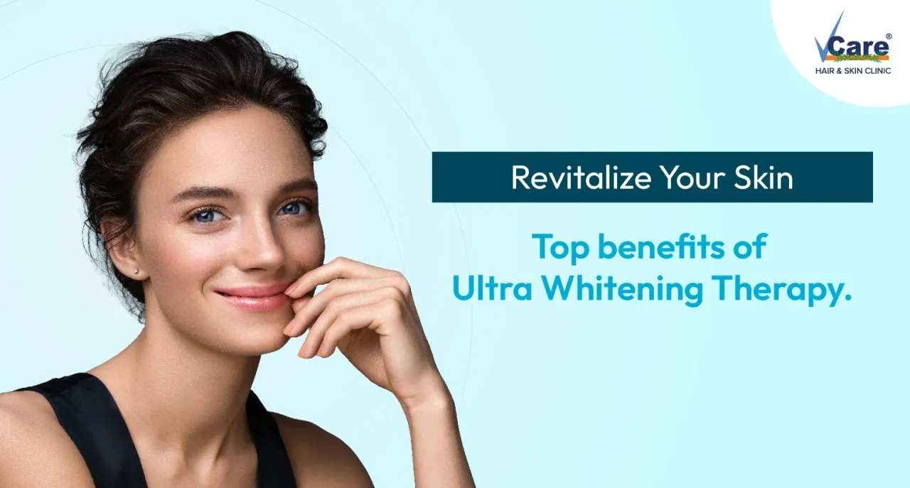 29389 professional teeth whitening