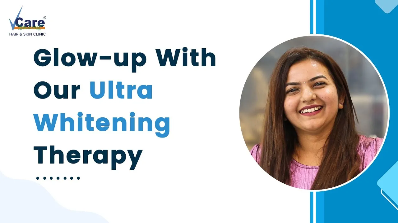 29389 teeth whitening before after