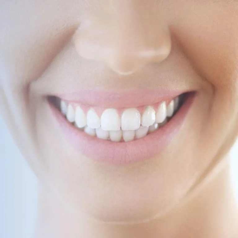 29395 teeth whitening worcester ma dentist consultation