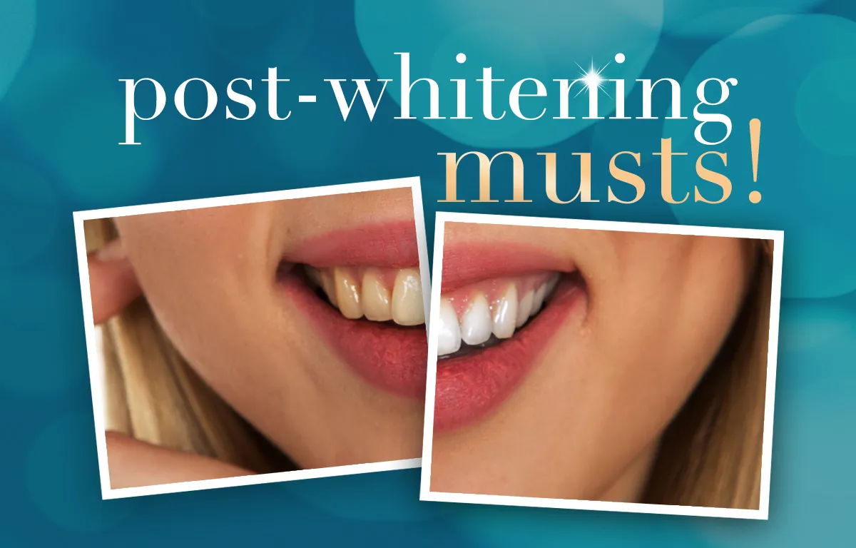 29401 teeth whitening aftercare image6