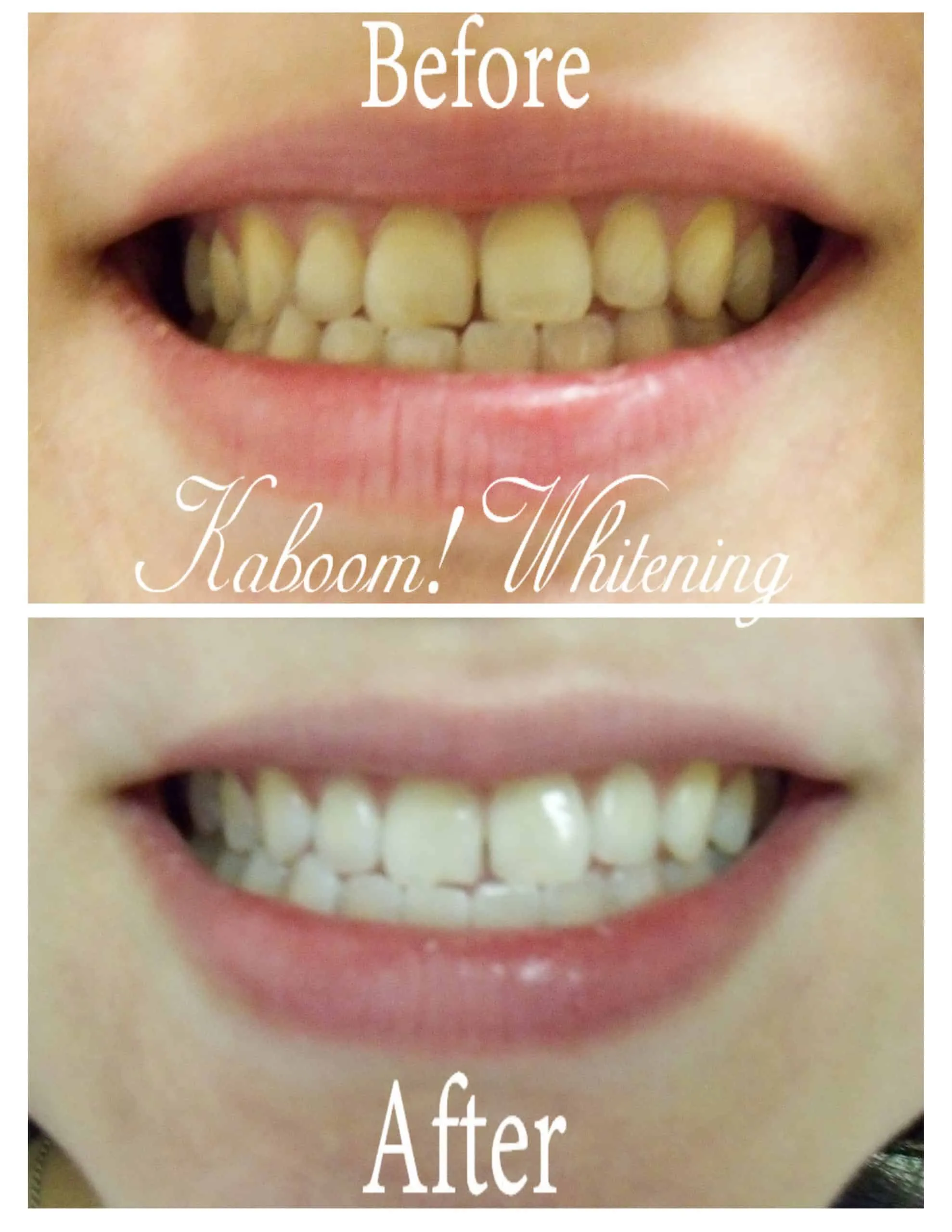 /img/29401-teeth-whitening-aftercare-image7.webp