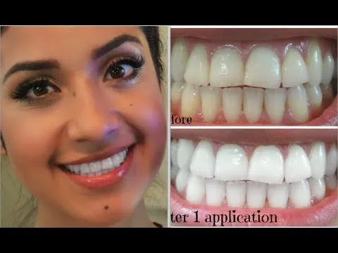 29408 dulce whitening ingredients