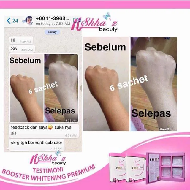 29412 skin hydration shhaz