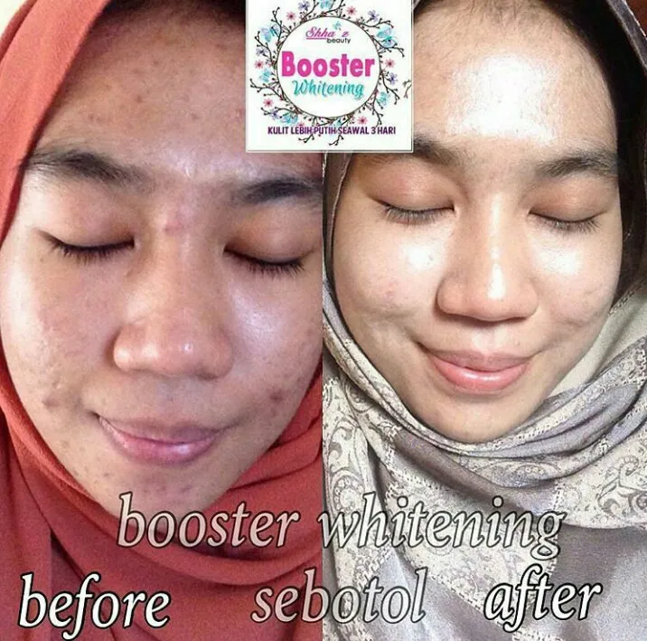 29412 skin texture shhaz