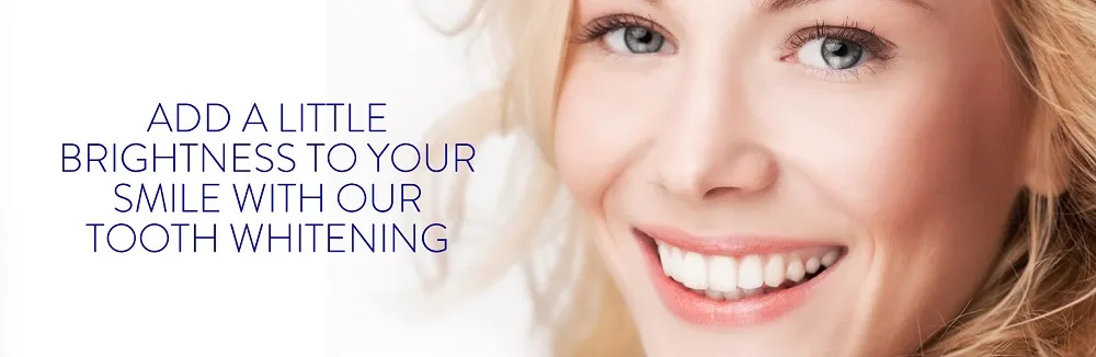 29420 teeth whitening cost