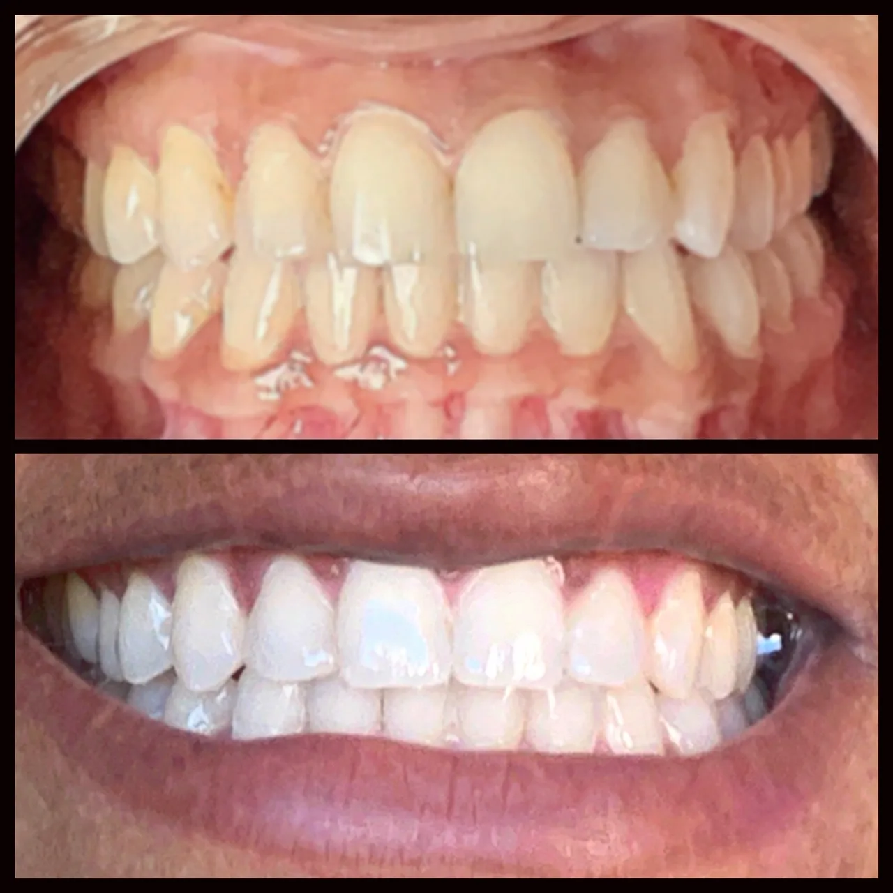 /img/29424-teeth-whitening-los-angeles-care.webp