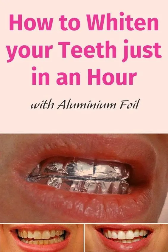 29428 over the counter strips