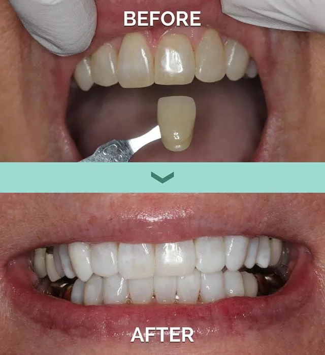 29430 boise dentist checkup