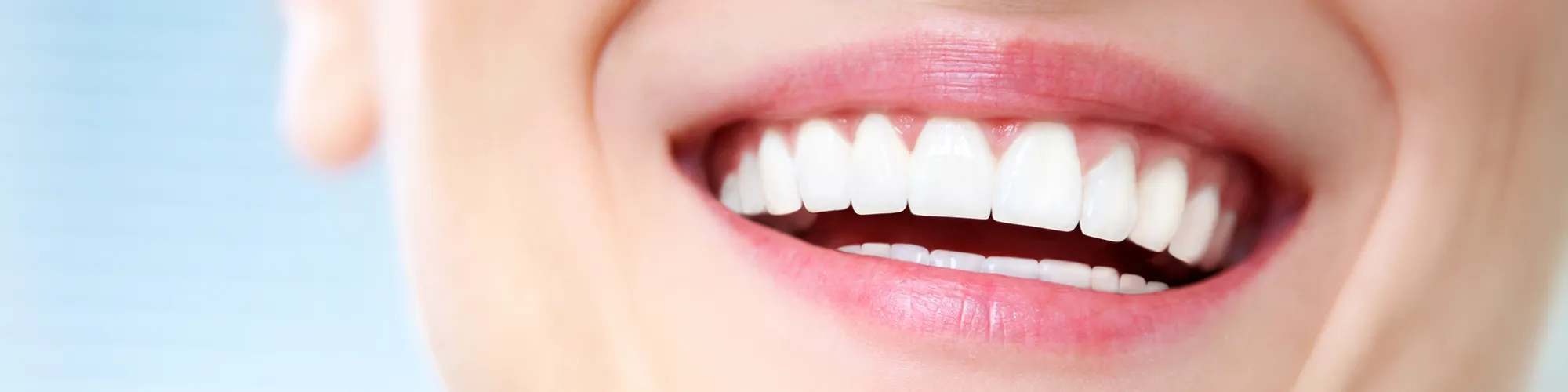 29431 zoom teeth whitening raleigh nc cost