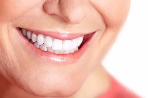 29444 at home teeth whitening visalia ca