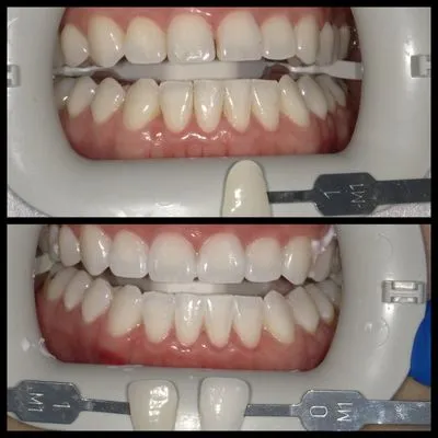 29446 finding daly city dentist