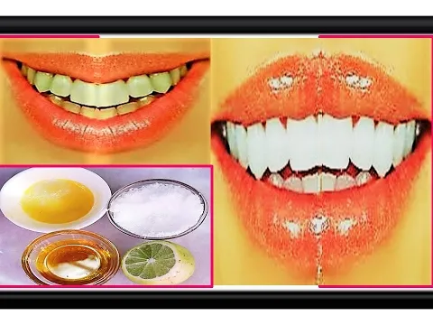 29451 baking soda lemon whitening