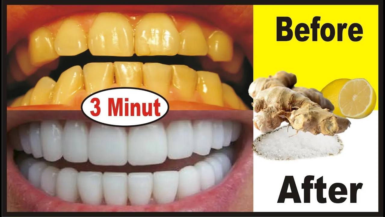 29451 causes of tooth discoloration