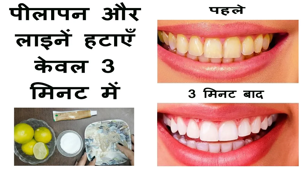 29451 teeth whitening hindi smile