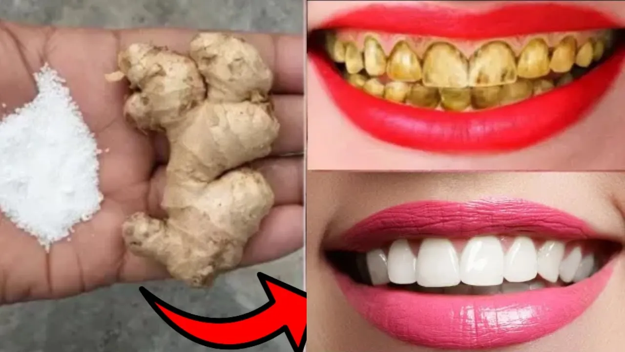 29451 turmeric teeth whitening