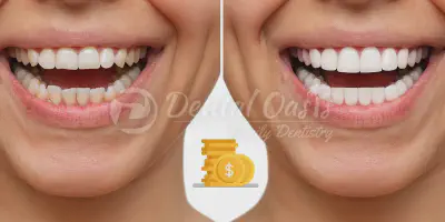 /img/29452-teeth-whitening-smiling.webp