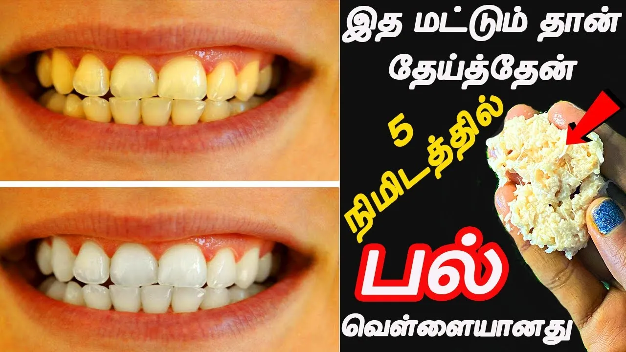 /img/29458-whitening-teeth-tamil.webp