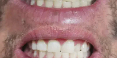 /img/29463-teeth-whitening-perth-wa-smile.webp