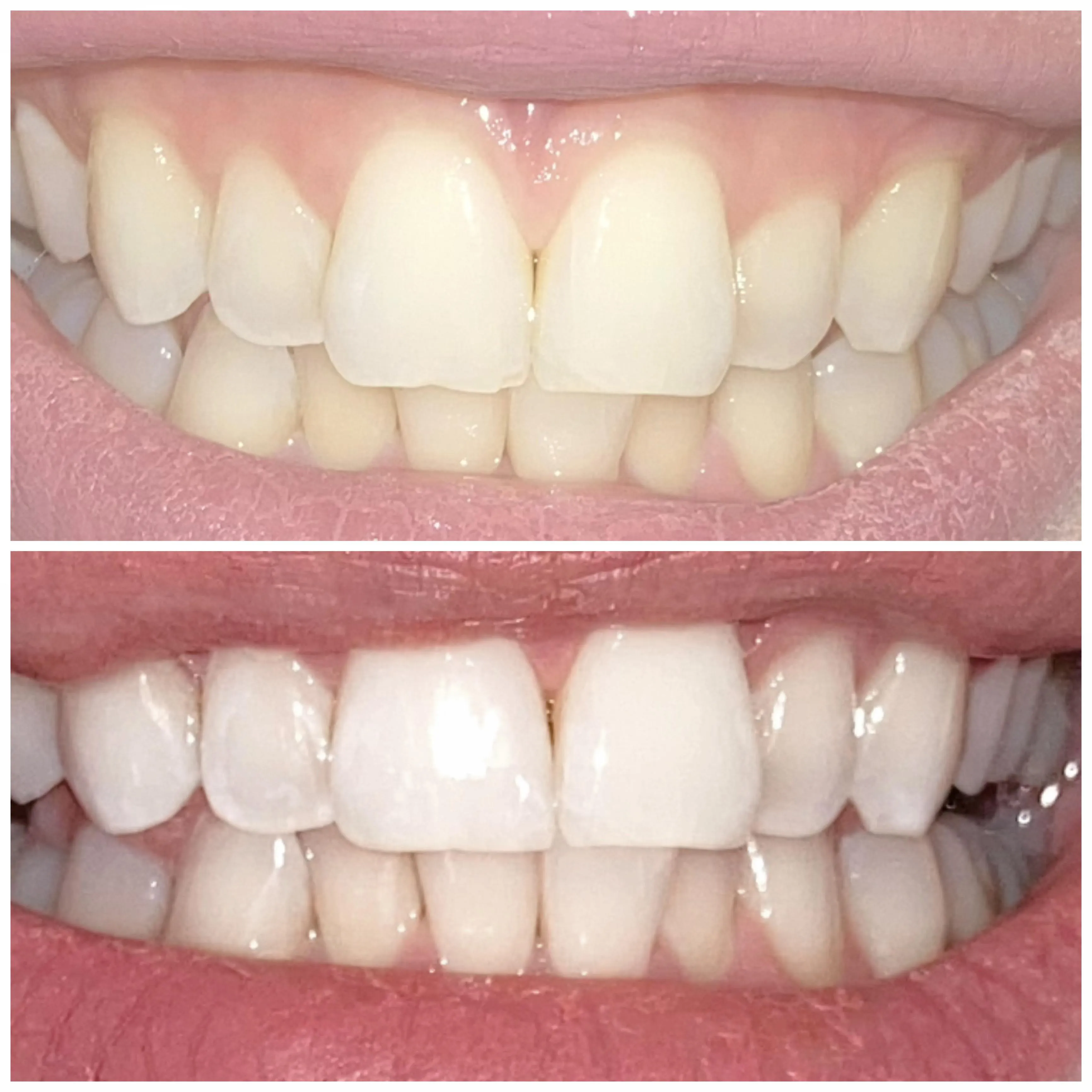 29464 tooth enamel structure