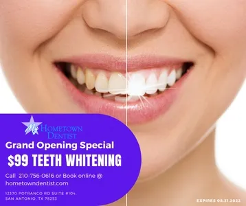/img/29465-teeth-whitening-aftercare.webp