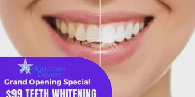 /img/29465-teeth-whitening-aftercare.webp