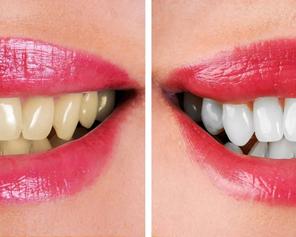 29472 proper brushing