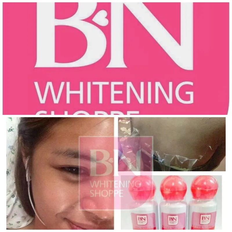 29474 whitening strips