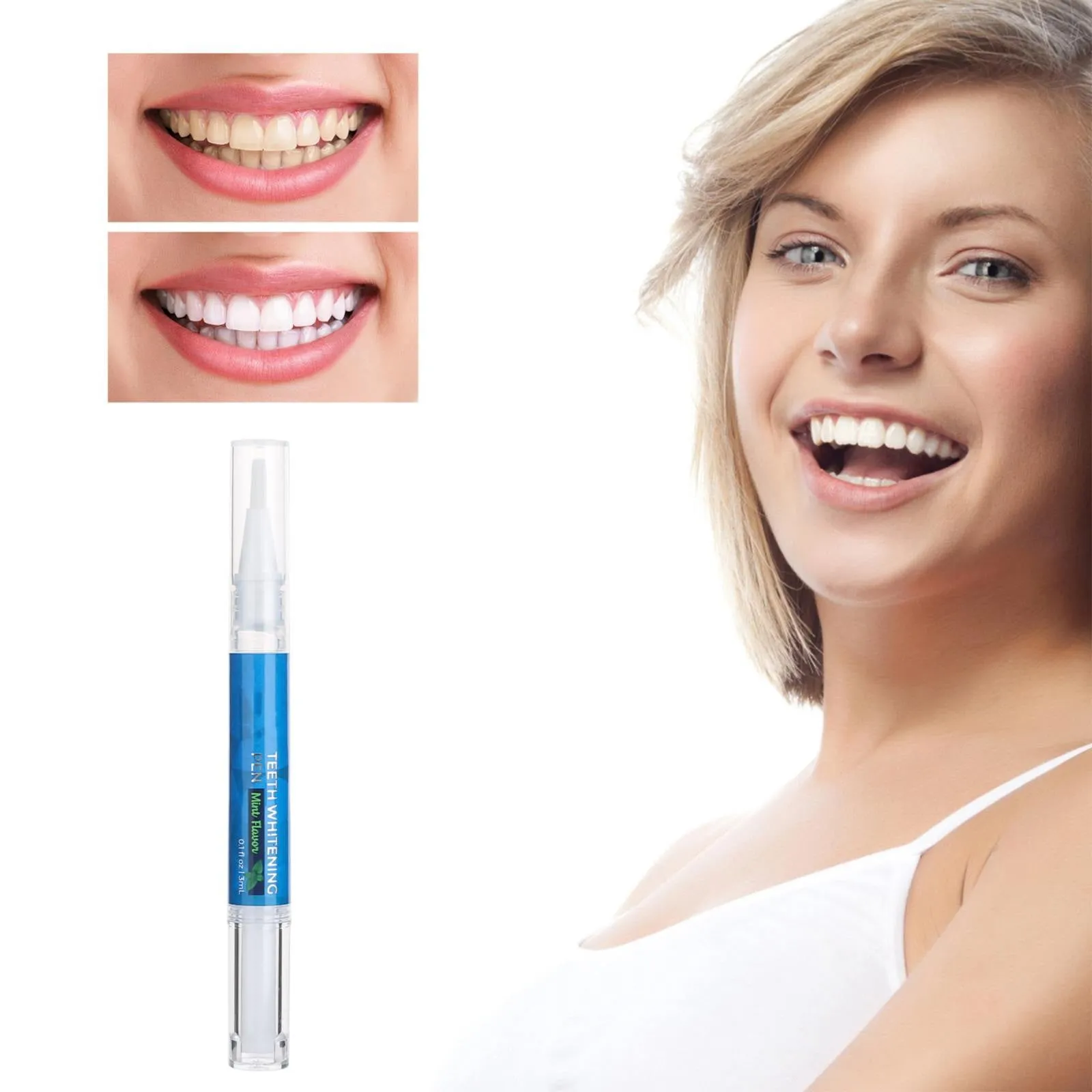 29475 professional whitening