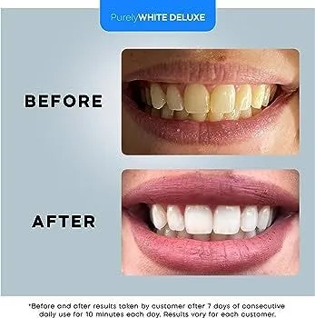 29486 teeth whitening before after