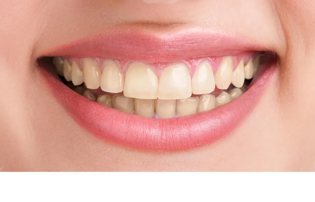 /img/29492-dental-consultation.webp