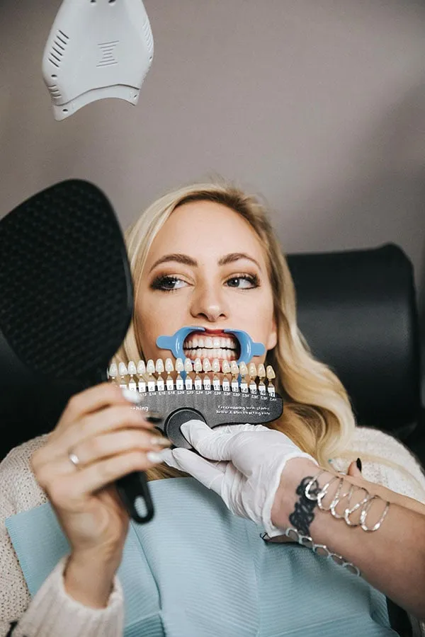 29500 in office whitening