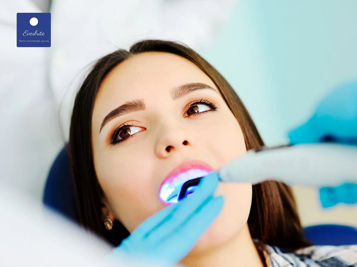 29501 at home teeth whitening kits