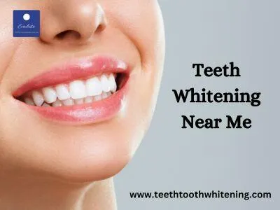 29501 smile makeover teeth whitening