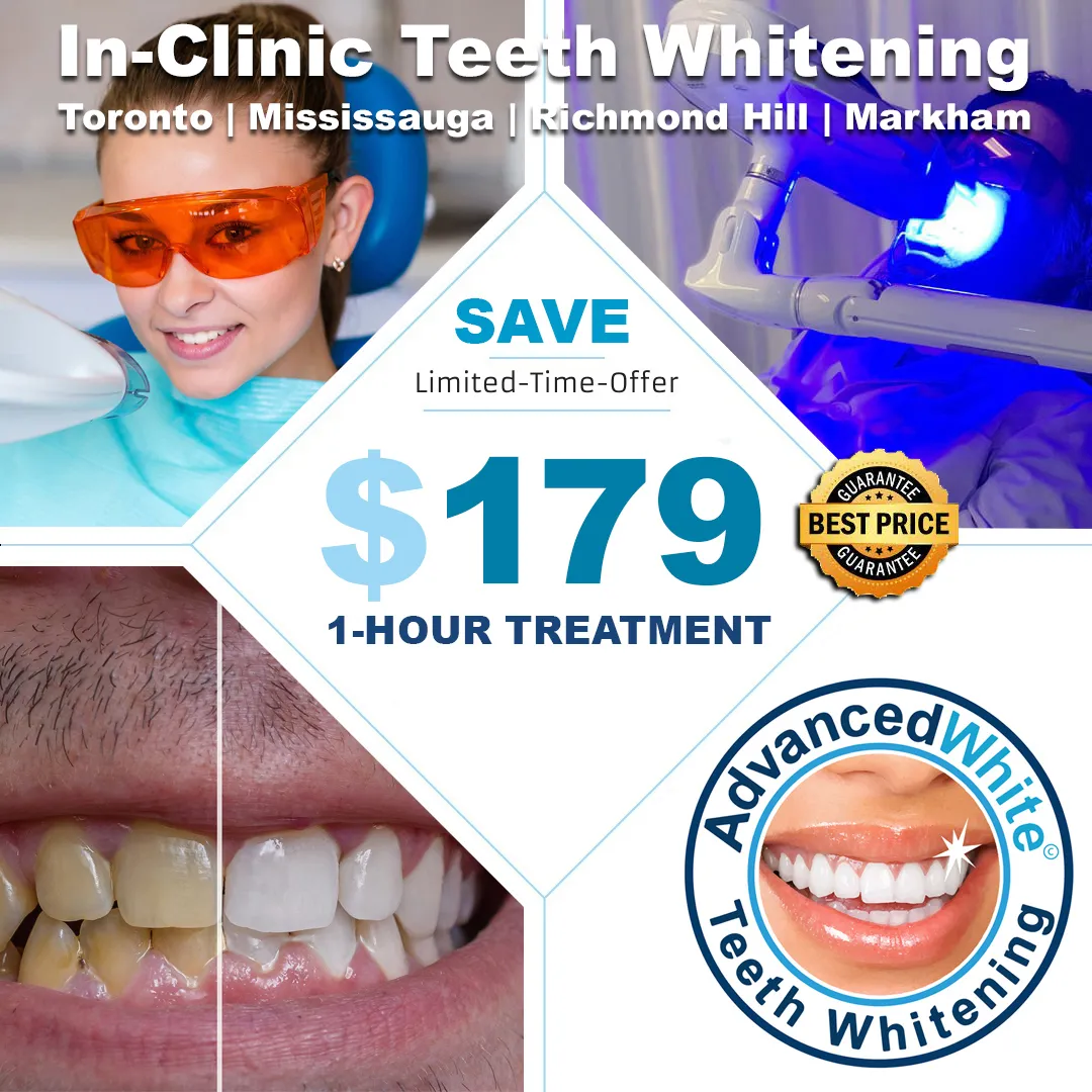 29501 teeth whitening before after