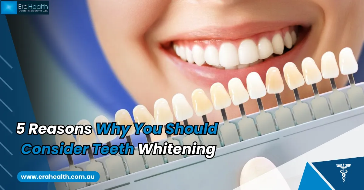 /img/29502-teeth-whitening-results.webp