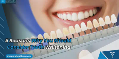 /img/29502-teeth-whitening-results.webp