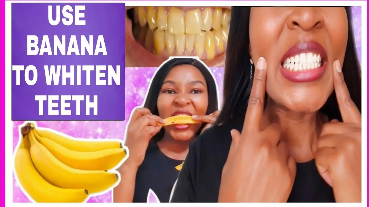 29503 teeth whitening results