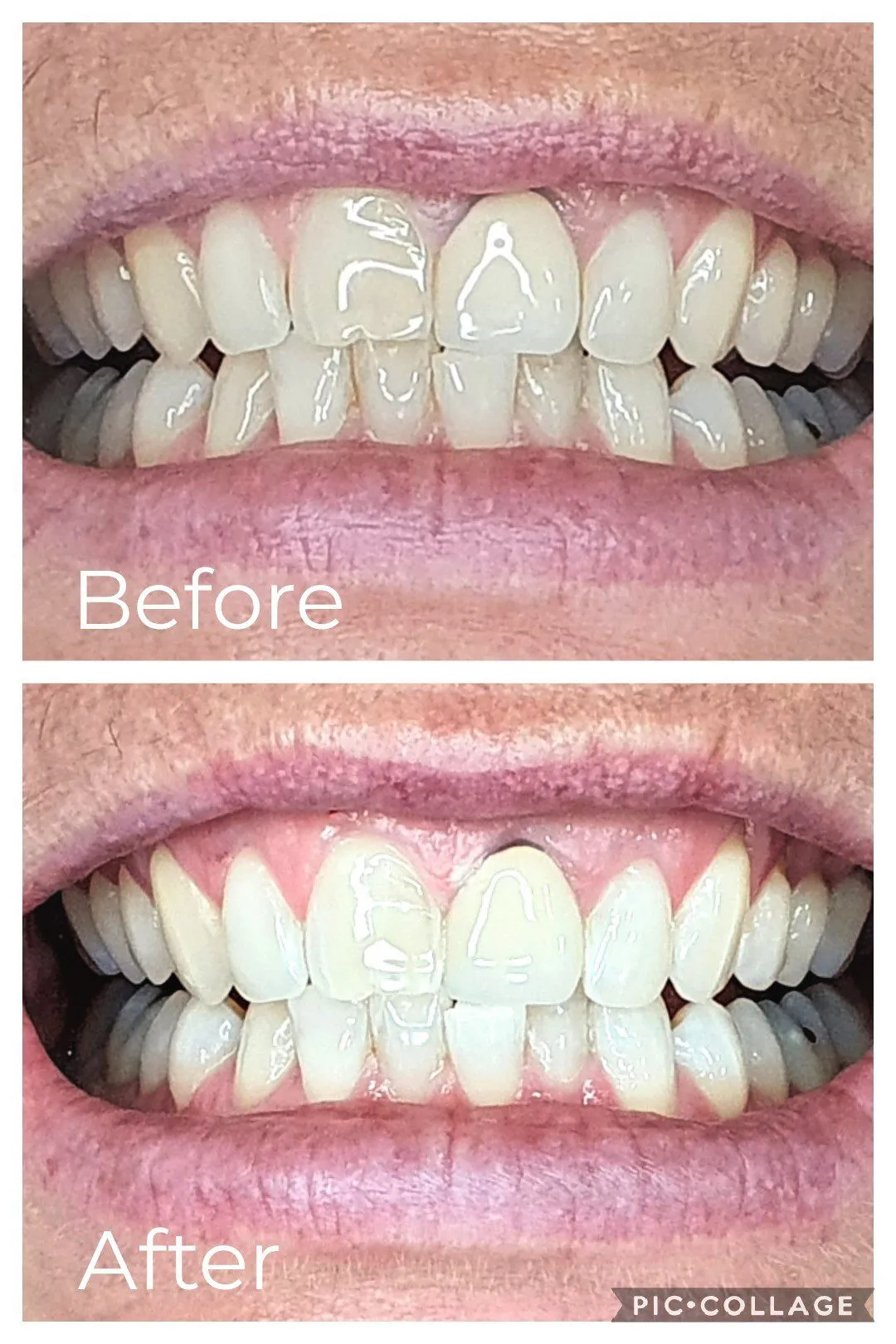 29506 dentist consultation