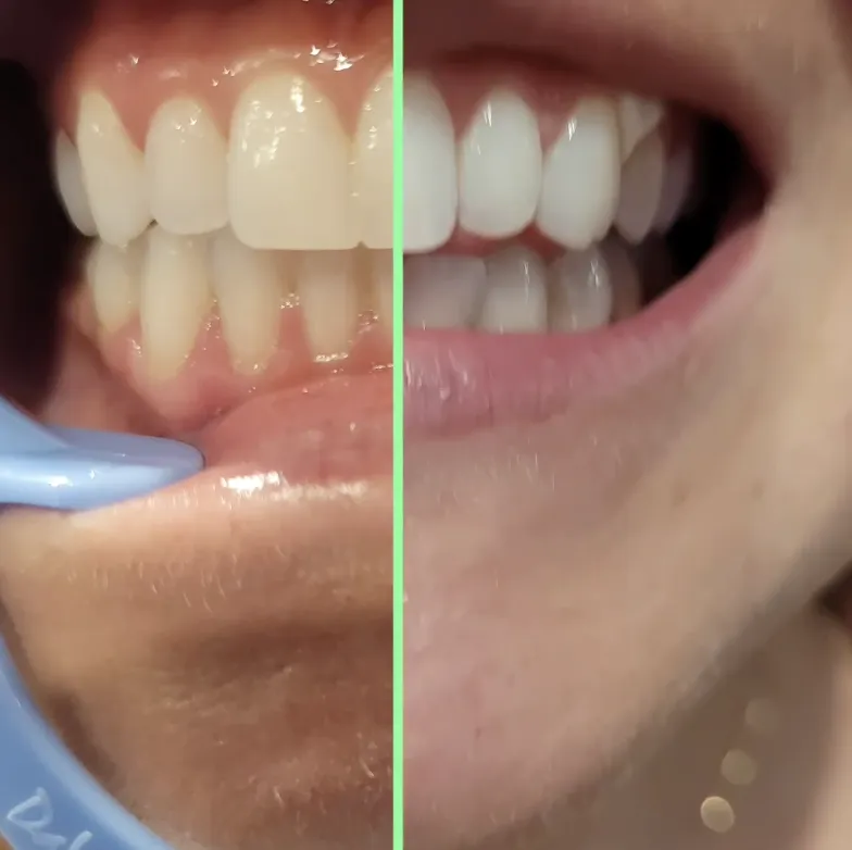 29508 find dentist fort collins