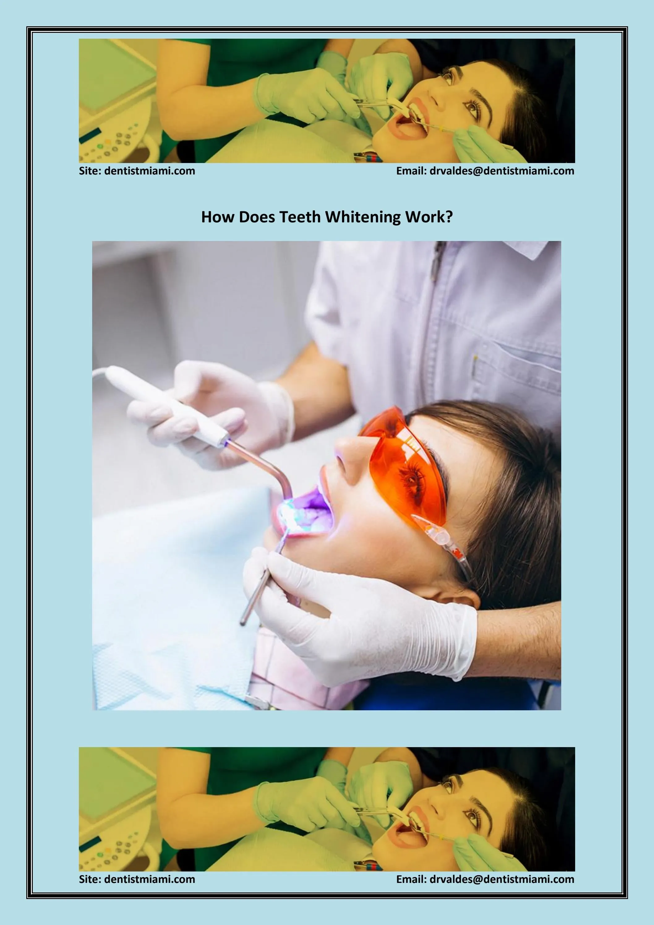 29514 teeth whitening enhanced aesthetics