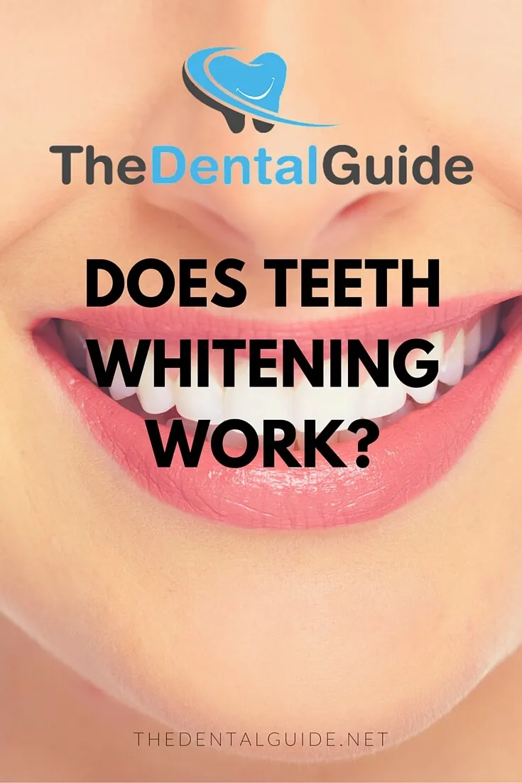 /img/29514-teeth-whitening-maintaining-smile.webp