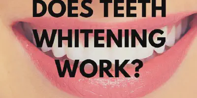 /img/29514-teeth-whitening-maintaining-smile.webp