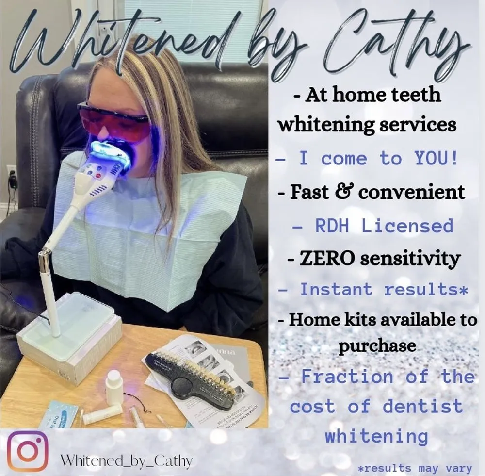 29517 in office teeth whitening